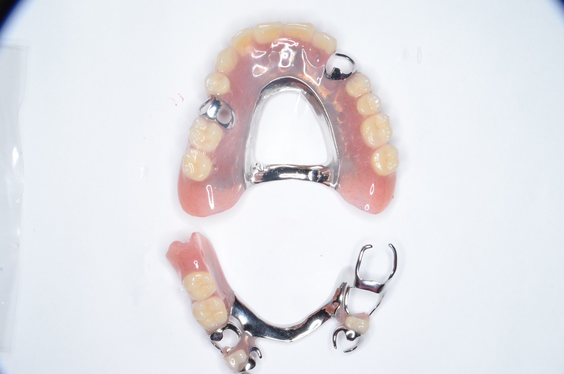 入れ歯 部分 部分入れ歯とは？特徴から構造・素材・治療費まで解説